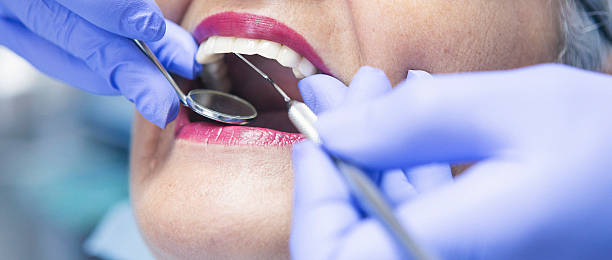 Best Emergency Tooth Extraction in Lochmoor Waterway Estates, FL